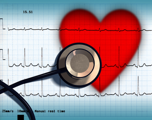 notes-on-a-24-hour-heart-monitor